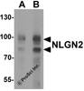 Western blot analysis of NLGN2 in rat brain tissue lysate with NLGN2 antibody at (A) 1 and (B) 2 &#956;g/ml.