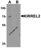 Western blot analysis of KIRREL2 in 293 cell lysate with KIRREL2 antibody at 1 &#956;g/ml in (A) the absence and (B) the presence of blocking peptide.