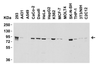 Figure 2 Western Blot Validation in Human and Mouse Cell Lines
Loading: 15 ug of lysates per lane.
Antibodies: Nephrin 7979 (2 ug/mL) , 1h incubation at RT in 5% NFDM/TBST.
Secondary: Goat anti-rabbit IgG HRP conjugate at 1:10000 dilution.