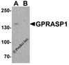 Western blot analysis of GPRASP1 in A-20 cell lysate with GPRASP1 antibody at 1 &#956;g/ml in (A) the absence and (B) the presence of blocking peptide.
