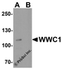 Western blot analysis of WWC1 in human brain tissue lysate with WWC1 antibody at 1 &#956;g/ml in (A) the absence and (B) the presence of blocking peptide.