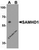 Figure 1 Western Blot Validation in Human Daudi Cell Lines
Loading: 15 &#956;g of lysates per lane.
Antibodies: SAMHD1 8007, 1 &#956;g/mL, in (A: the absence and B: the presence of blocking peptide) , (1h incubation at RT in 5% NFDM/TBST.
Secondary: Goat anti-rabbit IgG HRP conjugate at 1:10000 dilution.