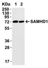Figure 2 Overexpression Validation in 293T Transfected Cells
Loading: 15 ug of lysates per lane.
Antibodies: SAMHD1 8007 (0.1 ug/mL) , (1h incubation at RT in 5% NFDM/TBST.
Secondary: Goat anti-rabbit IgG HRP conjugate at 1:10000 dilution.
293 cells were transfected with (1) wild-type SAMHD1 or (2) SAMHD1 (mutation T592A) .