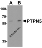 Western blot analysis of PTPN5 in Jurkat cell lysate with PTPN5 antibody at (A) 1 and (B) 2 &#956;g/ml.