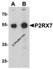 Western blot analysis of P2RX7 in 3T3 cell lysate with P2RX7 antibody at (A) 1 and (B) 2 &#956;g/ml.