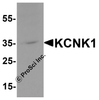 Western blot analysis of KCNK1 in 3T3 cell lysate with KCNK1 antibody at 1 &#956;g/ml.
