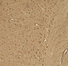 Immunohistochemistry of KCNK1 in mouse brain tissue with KCNK1 antibody at 5 ug/ml.