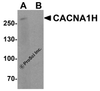 Western blot analysis of CACNA1H in 293 cell lysate with CACNA1H antibody at 1 &#956;g/ml in (A) the absence and (B) the presence of blocking peptide.