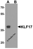 Western blot analysis of KLF17 in rat liver tissue lysate with KLF17 antibody at 1 &#956;g/ml in (A) the absence and (B) the presence of blocking peptide.