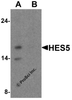 Western blot analysis of HES5 in Raji cell lysate with HES5 antibody at 1 &#956;g/ml (A) the absence and (B) the presence of blocking peptide.