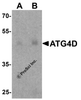 Western blot analysis of ATG4D in human testis tissue lysate with ATG4D antibody at (A) 1 and (B) 2 &#956;g/ml.
