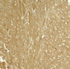 Immunohistochemistry of TAU in mouse brain tissue with TAU antibody at 5 ug/ml.