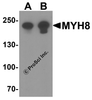 Western blot analysis of MYH8 in HeLa cell lysate with MYH8 antibody at (A) 0.5 and (B) 1 &#956;g/ml.