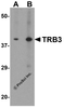 Western blot analysis of TRB3 in mouse kidney tissue lysate with TRB3 antibody at (A) 1 and (B) 2 &#956;g/ml.