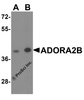 Western blot analysis of ADORA2B in mouse kidney tissue lysate with ADORA2B antibody at (A) 0.25 and (B) 0.5 &#956;g/mL