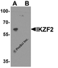 Western blot analysis of IKZF2 in EL4 cell lysate with IKZF2 antibody at 1 &#956;g/ml in (A) the absence and (B) the presence of blocking peptide.