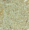 Immunohistochemistry of ADRM1 in human spleen tissue with ADRM1 antibody at 5 ug/mL.