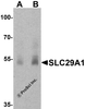 Western blot analysis of SLC29A1 in human ovary tissue lysate with SLC29A1 antibody at (A) 1 and (B) 2 &#956;g/ml.