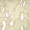 Immunohistochemistry of SLC29A1 in human ovary tissue with SLC29A1 antibody at 5 ug/mL.