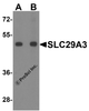 Western blot analysis of SLC29A3 in mouse bladder tissue lysate with SLC29A3 antibody at (A) 1 and (B) 2 &#956;g/ml.