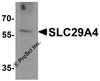 Western blot analysis of SLC29A4 in SK-N-SH cell lysate with SLC29A4 antibody at 1 &#956;g/ml.