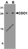 Western blot analysis of CDO1 in rat liver tissue lysate with CDO1 antibody at (A) 1 and (B) 2 &#956;g/ml.