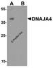 Western blot analysis of DNAJA4 in human colon tissue lysate with DNAJA4 antibody at 1 &#956;g/ml in (A) the absence and (B) the presence of blocking peptide.