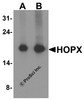 Western blot analysis of HOPX in human brain tissue lysate with HOPX antibody at (A) 1 and (B) 2 &#956;g/ml.