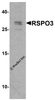 Western blot analysis of RSPO3 in 293 cell lysate with RSPO3 antibody at 1 &#956;g/ml.