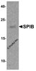 Western blot analysis of SPIB in human prostate tissue lysate with SPIB antibody at 1 &#956;g/ml.