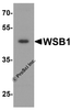 Western blot analysis of WSB1 in human colon tissue lysate with WSB1 antibody at 1 &#956;g/ml.