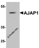 Western blot analysis of AJAP1 in rat liver tissue lysate with AJAP1 antibody at 1 &#956;g/ml.