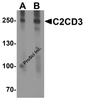 Western blot analysis of C2CD3 in EL4 cell lysate with C2CD3 antibody at (A) 1 and (B) 2 &#956;g/ml.