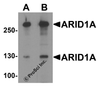 Western blot analysis of ARID1A in SK-N-SH cell lysate with ARID1A antibody at (A) 1 and (B) 2 &#956;g/ml.