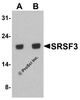Western blot analysis of SRSF3 in K562 cell lysate with SRSF3 antibody at (A) 1 and (B) 2 &#956;g/ml.