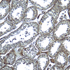 Immunohistochemistry of ADAM29 in human testis tissue with ADAM29 antibody at 5 ug/mL.