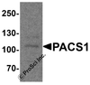 Western blot analysis of PACS1 in rat bladder tissue lysate with PACS1 antibody at 1 &#956;g/ml.