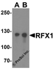 Western blot analysis of RFX1 in HeLa cell lysate with RFX1 antibody at (A) 1 and (B) 2 &#956;g/ml.