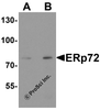 Western blot analysis of ERp72 in human colon tissue lysate with ERp72 antibody at (A) 1 and (B) 2 &#956;g/ml.