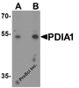 Western blot analysis of PDIA1 in rat small intestine tissue lysate with PDIA1 antibody at (A) 1 and (B) 2 &#956;g/ml.