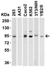 Figure 1 Western Blot Validation in Cell Lines
Loading: 15 &#956;g of lysates per lane.
Antibodies: LSD1 8223 (2 &#956;g/mL) , 1h incubation at RT in 5% NFDM/TBST.
Secondary: Goat anti-rabbit IgG HRP conjugate at 1:10000 dilution.