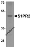 Western blot analysis of S1PR2 in HeLa cell lysate with S1PR2 antibody at 1 &#956;g/ml.