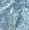 Immunohistochemistry of PALMD in human bladder tissue with PALMD antibody at 2.5 ug/mL.