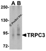 Western blot analysis of TRPC3 in human cerebellum tissue lysate with TRPC3 antibody at (A) 1 and (B) 2 &#956;g/ml.