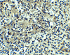 Immunohistochemistry of DEPDC1B in human spleen tissue with DEPDC1B antibody at 5 ug/ml.