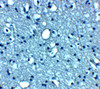 Immunohistochemistry of VTI1b in human brain tissue with VTI1b antibody at 5 ug/mL.