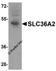 Western blot analysis of SLC36A2 in human stomach tissue lysate with SLC36A2 antibody at1 &#956;g/ml.