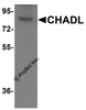 Western blot analysis of CHADL in mouse kidney tissue lysate with CHADL antibody at (A) 1 and (B) 2 &#956;g/ml.