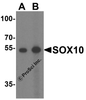 Western blot analysis of SOX10 in rat heart tissue lysate with SOX10 antibody at (A) 1 and (B) 2 &#956;g/mL.