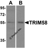 Western blot analysis of TRIM58 in (A) human heart tissue and (B) mouse kidney lysate with TRIM58 antibody at 1 &#956;g/mL.